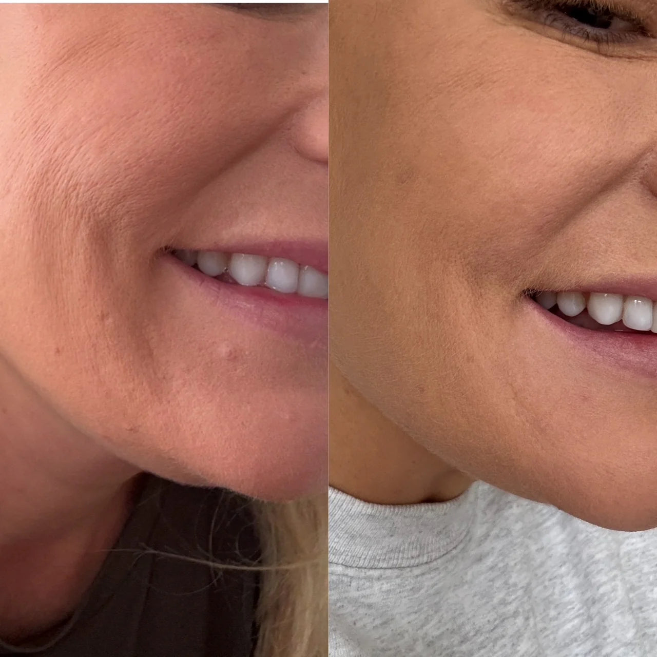 RUCI Marine Collagen